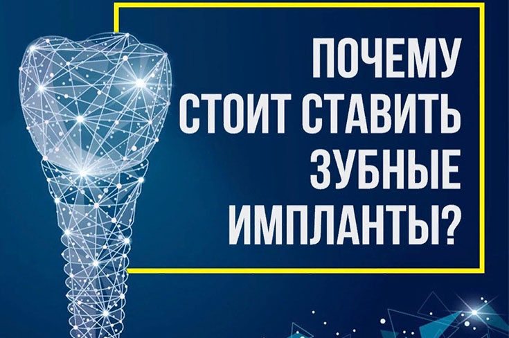 Почему стоит ставить импланты?
