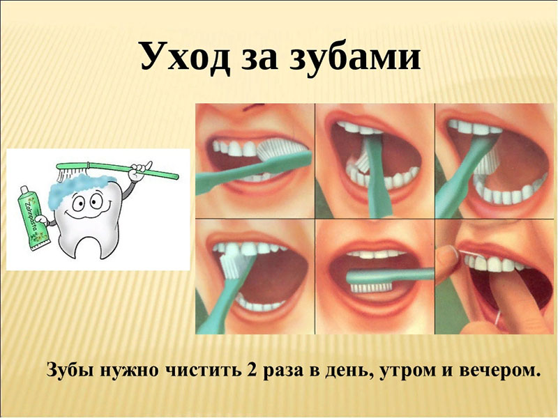 Уход за зубами!