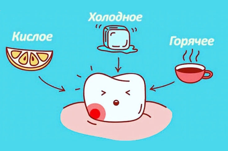 Повышенная чувствительность как причина зубной боли